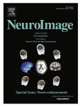 NeuroImage NeuroImage